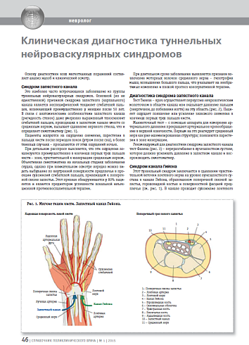 Клиническая диагностика туннельных нейроваскулярных синдромов