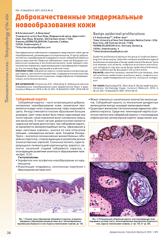 Доброкачественные эпидермальные новообразования кожи