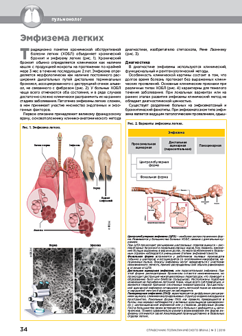 Эмфизема легких