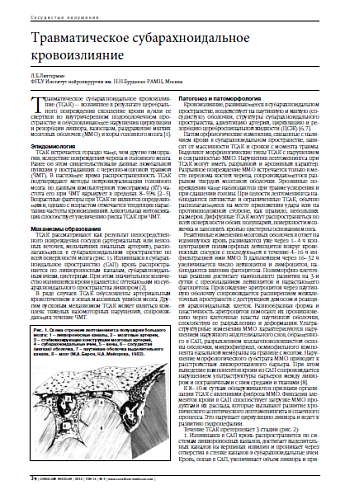 Травматическое субарахноидальное кровоизлияние