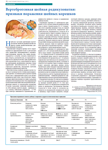 Вертеброгенная шейная радикулопатия:  признаки поражения шейных корешков