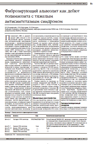 Фиброзирующий альвеолит как дебютполимиозита с тяжелым антисинтетазнымсиндромом