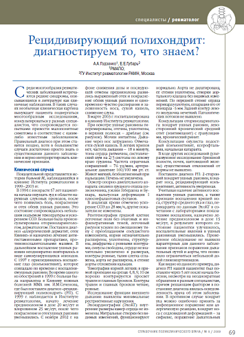 Рецидивирующий полихондрит: диагностируем то, что знаем?