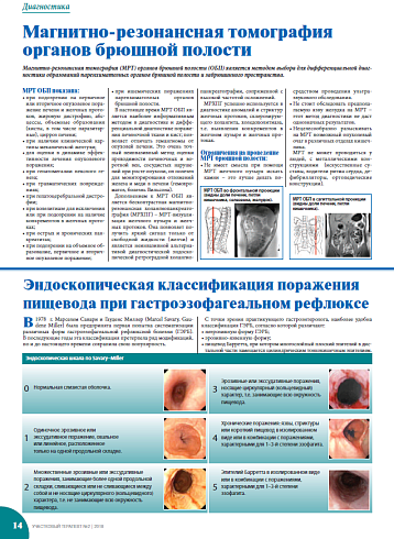 Эндоскопическая классификация поражения пищевода при гастроэзофагеальном рефлюксе