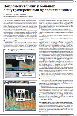 Нейромониторинг у больных с внутричерепными кровоизлияниями