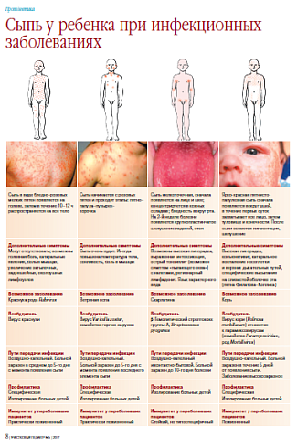 Сыпь у ребенка при инфекционных заболеваниях