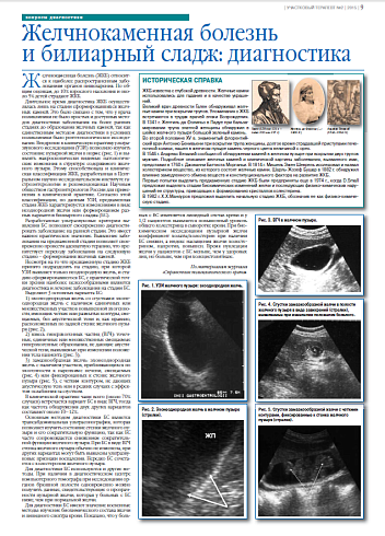 Желчнокаменная болезнь  и билиарный сладж: диагностика