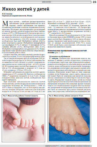 Микоз ногтей у детей