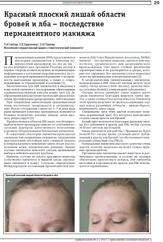 Красный плоский лишай области бровей и лба – последствие перманентного макияжа